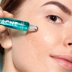 Mádara Acne Acute Spot Roll-on in a turquoise bottle being applied to the cheek.